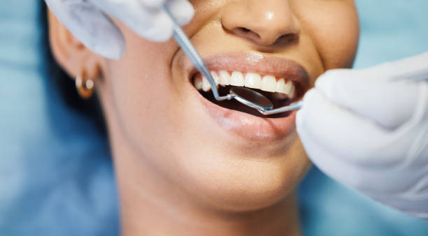 Best Emergency Dentist for Lost Fillings or Crowns in Kiefer, OK